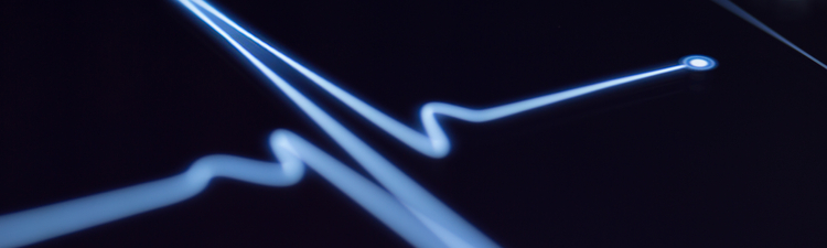 Close-up of electrocardiogram (ECG) machine readout.