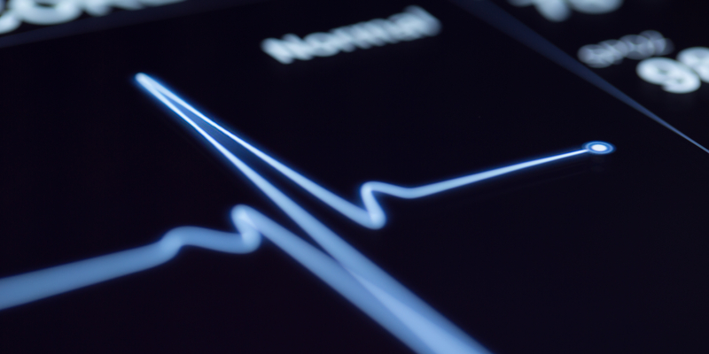 Close-up of electrocardiogram (ECG) machine readout.