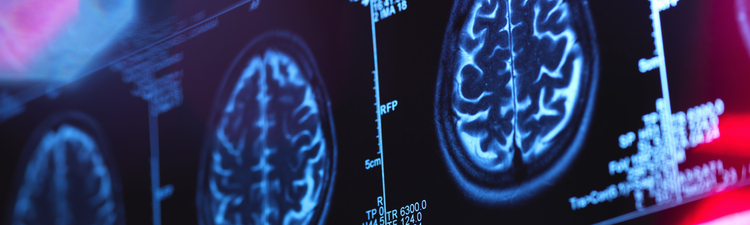 Close-up of medical imaging of human brain.