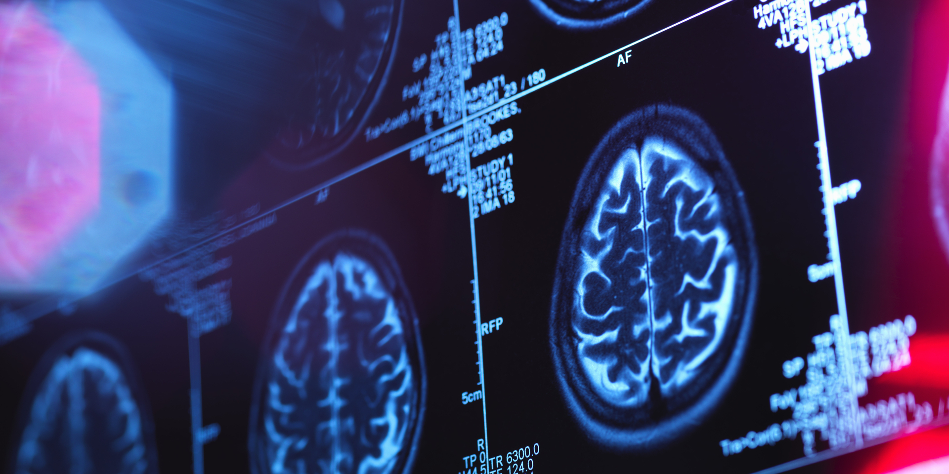 Close-up of medical imaging of human brain.