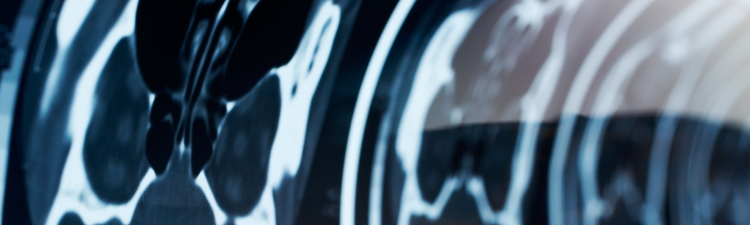 Close-up of medical imaging from computed tomography (CT) scan.