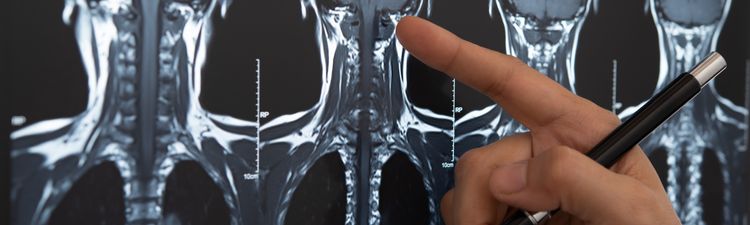Close-up of radiologist review MRI scan of brain and spine.