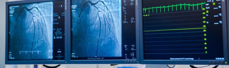 Medium angle of digital displays and monitors in medical facility.