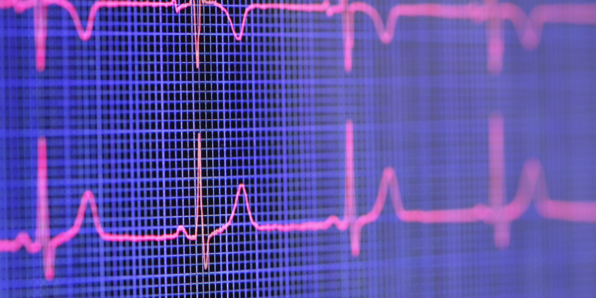 Electrocardiogram-Electrocardiogram displayed on the screen of a tablet computer.