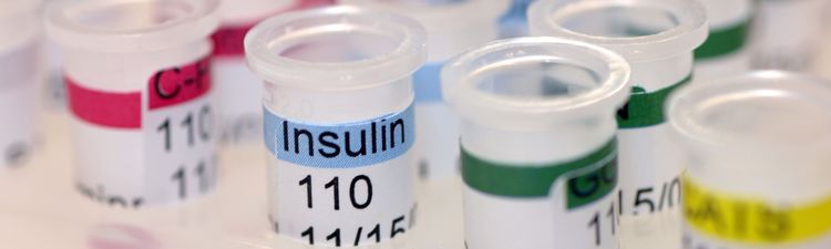 Close-up of test tubes of insulin samples in laboratory.